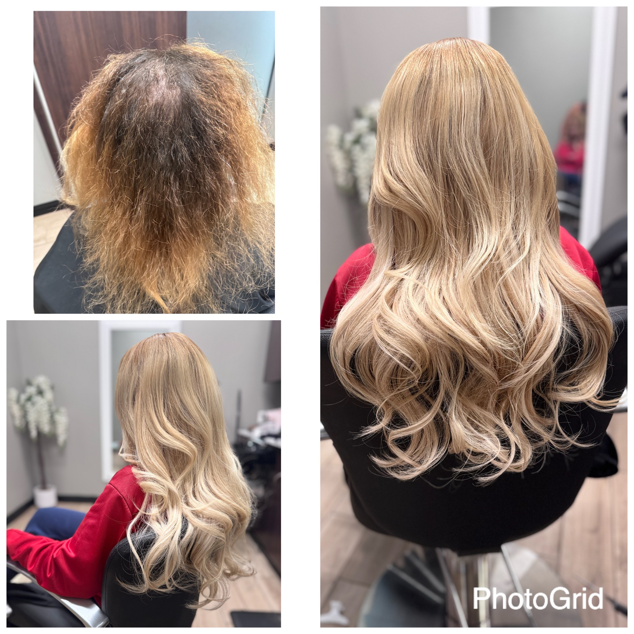 Mesh integration system for hair loss before and after results